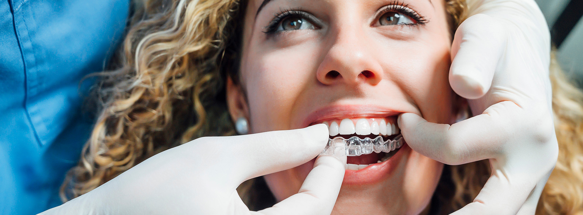 San Jose Cosmetic Dentist