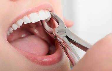 Cosmetic Dental Office in San Jose