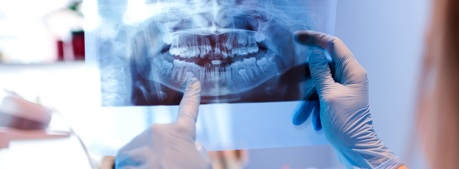 Family Dentist in San Jose